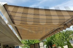 retractable-awnings-06